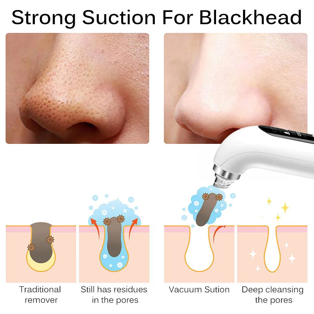 USB Rechargeable Blackhead Remover