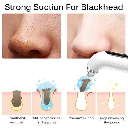 USB Rechargeable Blackhead Remover